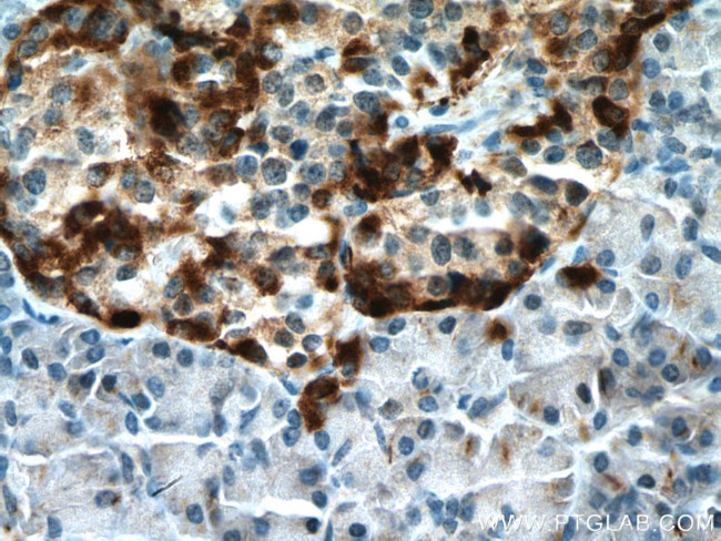 SLC30A8/ZNT8 Antibody in Immunohistochemistry (Paraffin) (IHC (P))