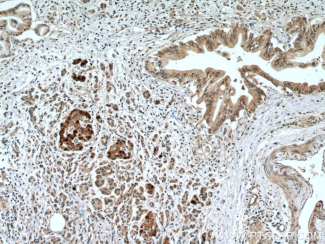 SLC30A8/ZNT8 Antibody in Immunohistochemistry (Paraffin) (IHC (P))