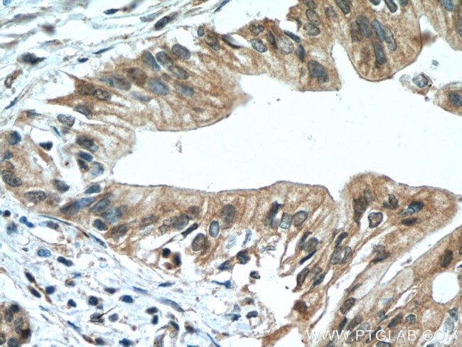 SLC30A8/ZNT8 Antibody in Immunohistochemistry (Paraffin) (IHC (P))