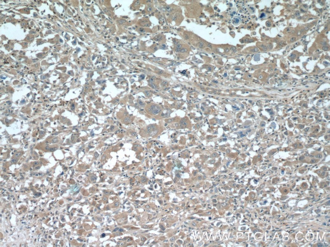 SLC30A8/ZNT8 Antibody in Immunohistochemistry (Paraffin) (IHC (P))