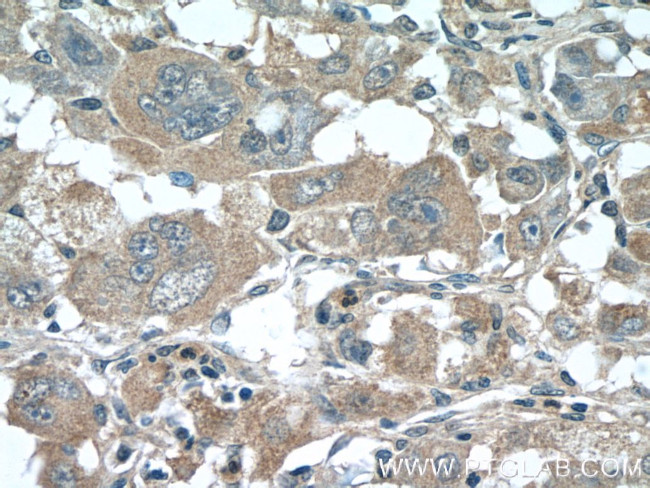 SLC30A8/ZNT8 Antibody in Immunohistochemistry (Paraffin) (IHC (P))