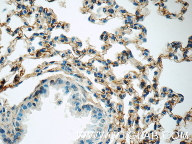 Icam-1 Antibody in Immunohistochemistry (Paraffin) (IHC (P))