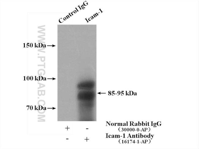 Icam-1 Antibody in Immunoprecipitation (IP)