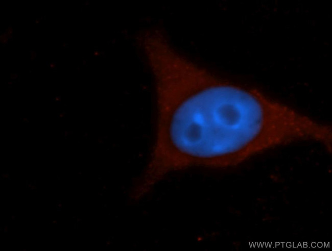 Icam-1 Antibody in Immunocytochemistry (ICC/IF)