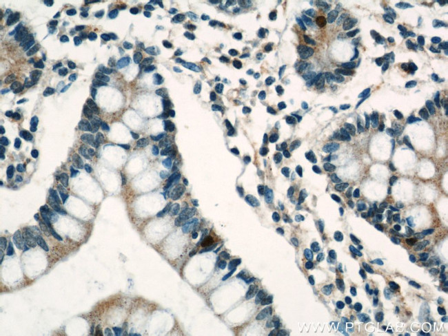 Lin28A Antibody in Immunohistochemistry (Paraffin) (IHC (P))