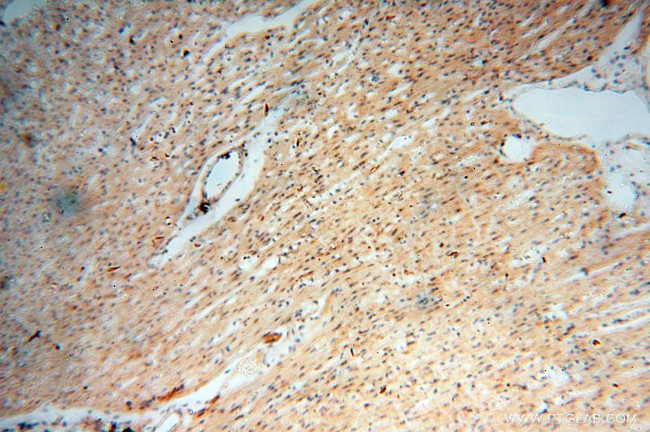 Lin28A Antibody in Immunohistochemistry (Paraffin) (IHC (P))