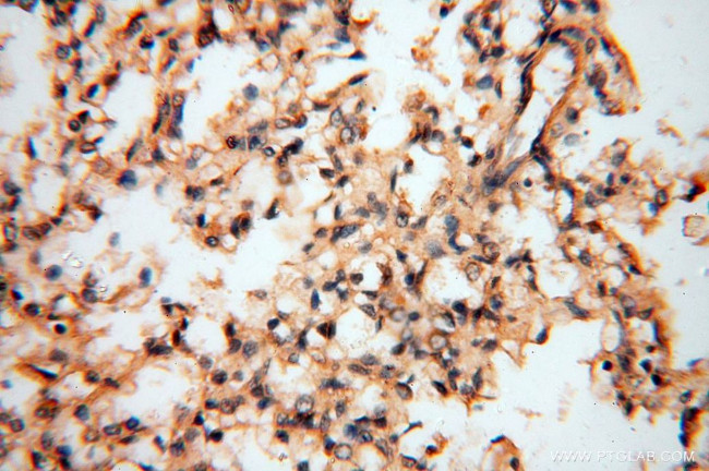 Lin28A Antibody in Immunohistochemistry (Paraffin) (IHC (P))