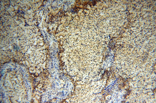 Lin28A Antibody in Immunohistochemistry (Paraffin) (IHC (P))