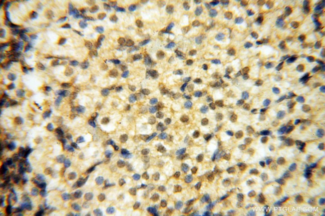 Lin28A Antibody in Immunohistochemistry (Paraffin) (IHC (P))