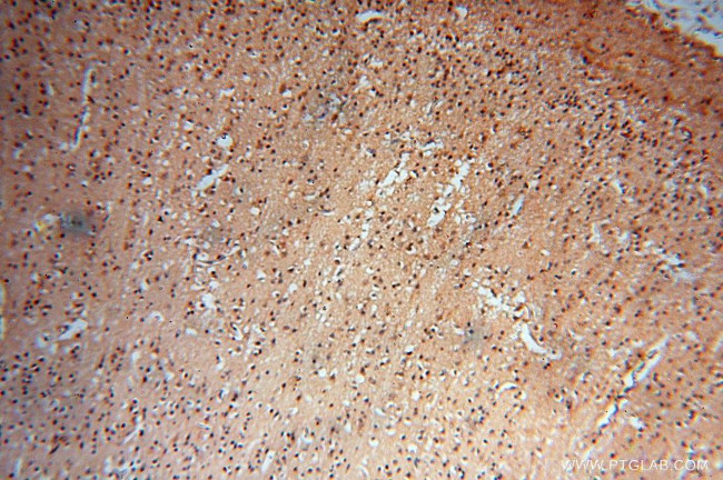 Lin28A Antibody in Immunohistochemistry (Paraffin) (IHC (P))