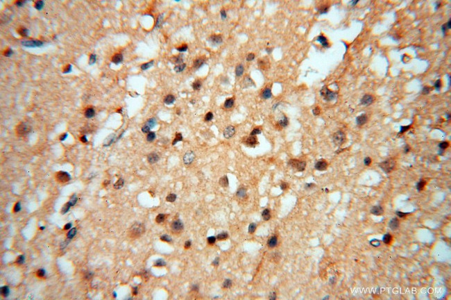 Lin28A Antibody in Immunohistochemistry (Paraffin) (IHC (P))