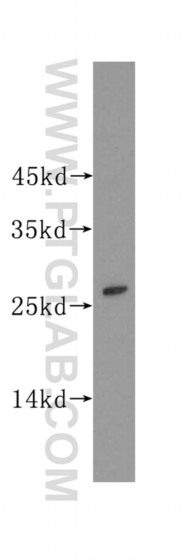 Lin28A Antibody in Western Blot (WB)