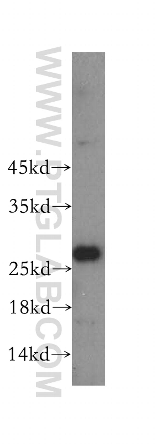 Lin28A Antibody in Western Blot (WB)