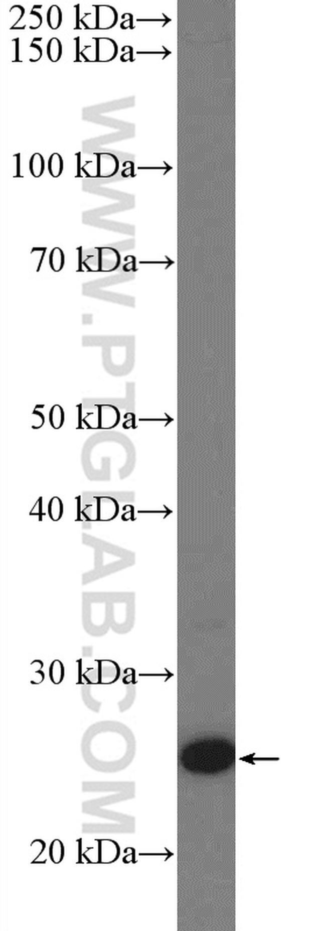 Lin28A Antibody in Western Blot (WB)