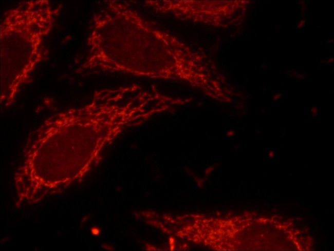 Lin28B Antibody in Immunocytochemistry (ICC/IF)