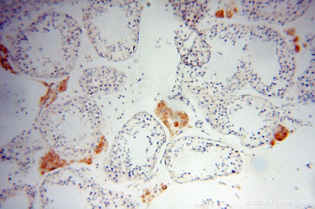 Lin28B Antibody in Immunohistochemistry (Paraffin) (IHC (P))