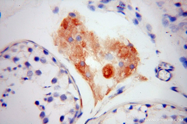 Lin28B Antibody in Immunohistochemistry (Paraffin) (IHC (P))