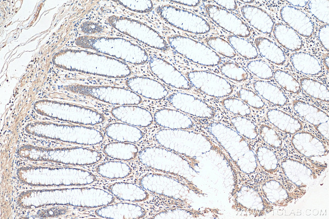 Lin28B Antibody in Immunohistochemistry (Paraffin) (IHC (P))