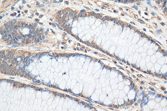 Lin28B Antibody in Immunohistochemistry (Paraffin) (IHC (P))