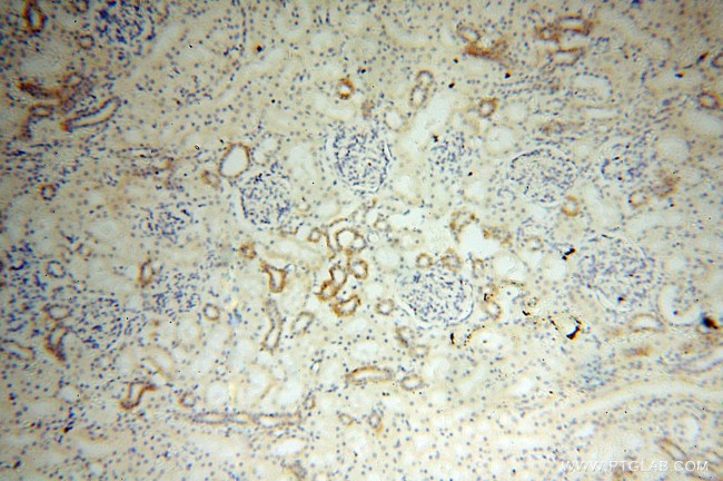 Lin28B Antibody in Immunohistochemistry (Paraffin) (IHC (P))