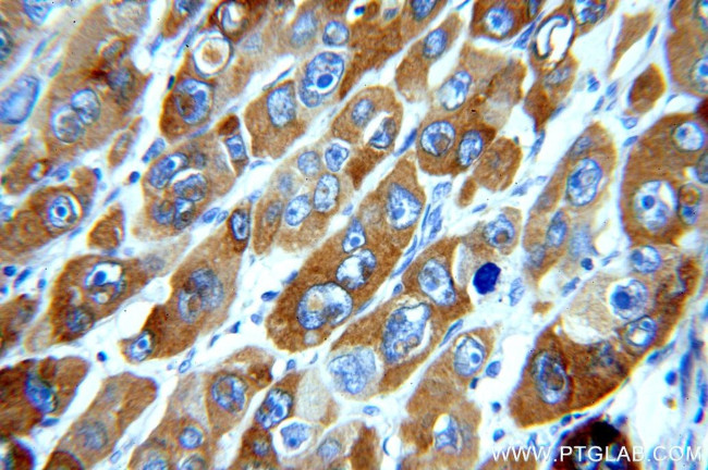 Lin28B Antibody in Immunohistochemistry (Paraffin) (IHC (P))