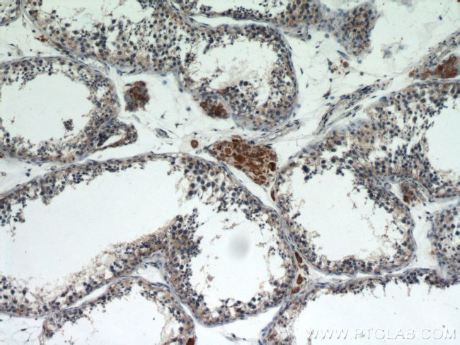 Lin28B Antibody in Immunohistochemistry (Paraffin) (IHC (P))