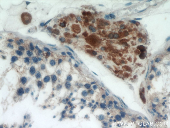 Lin28B Antibody in Immunohistochemistry (Paraffin) (IHC (P))