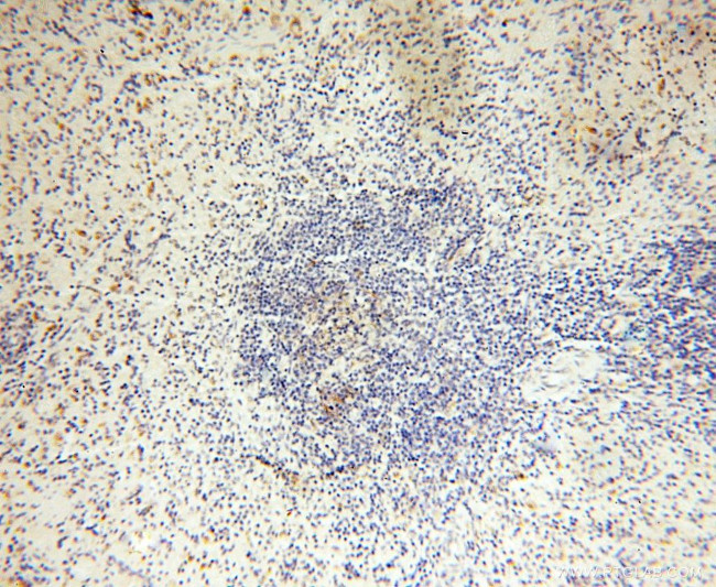 Lin28B Antibody in Immunohistochemistry (Paraffin) (IHC (P))