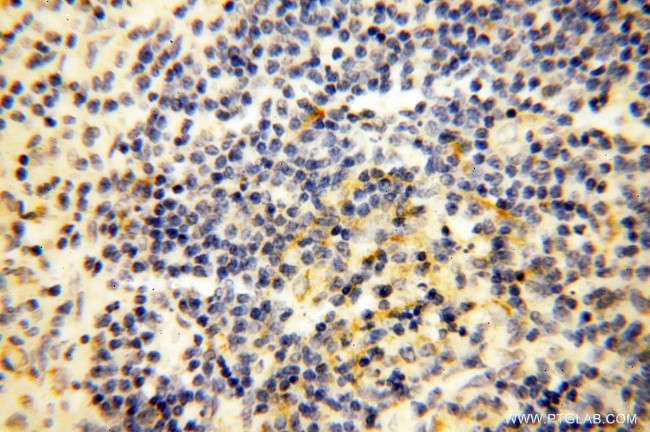 Lin28B Antibody in Immunohistochemistry (Paraffin) (IHC (P))