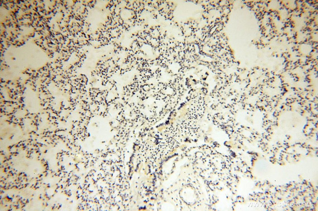 Lin28B Antibody in Immunohistochemistry (Paraffin) (IHC (P))