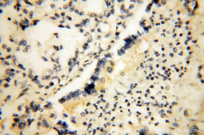 Lin28B Antibody in Immunohistochemistry (Paraffin) (IHC (P))