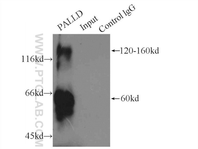 Palladin Antibody in Immunoprecipitation (IP)