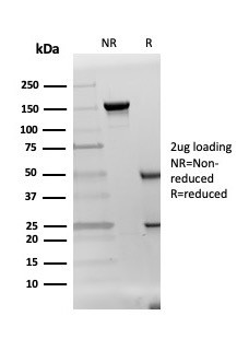 DAZL (Deleted in Azoospermia-like) Antibody in SDS-PAGE (SDS-PAGE)