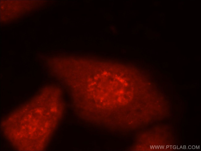 MYPN Antibody in Immunocytochemistry (ICC/IF)