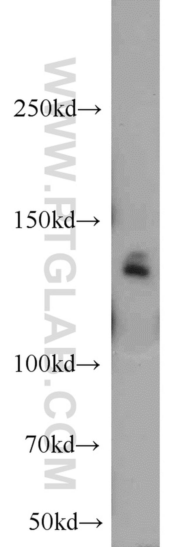 MYPN Antibody in Western Blot (WB)