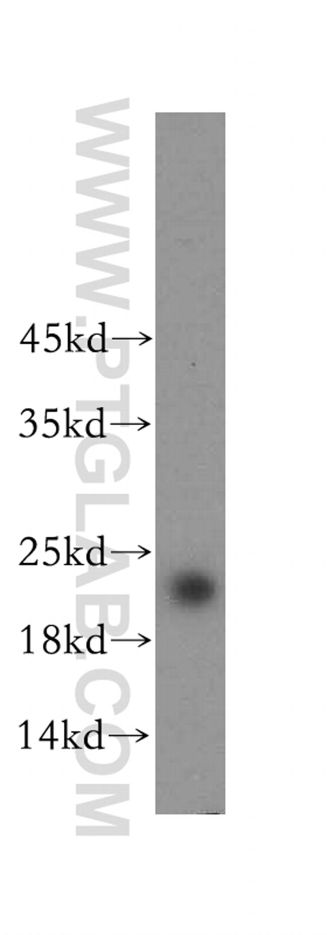 RAB22A Antibody in Western Blot (WB)