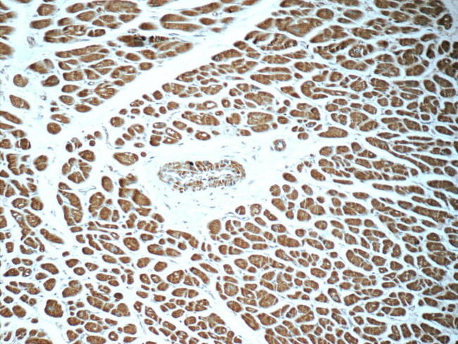 RAB31 Antibody in Immunohistochemistry (Paraffin) (IHC (P))