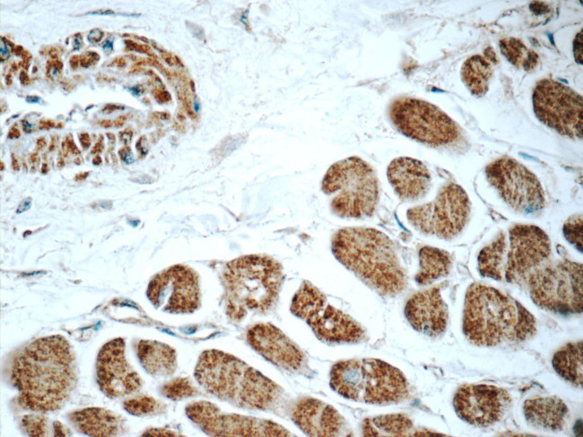 RAB31 Antibody in Immunohistochemistry (Paraffin) (IHC (P))