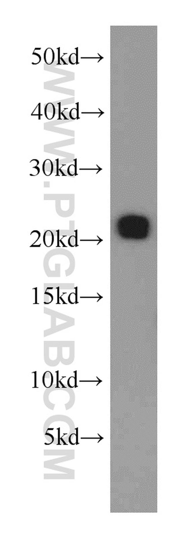 RAB31 Antibody in Western Blot (WB)