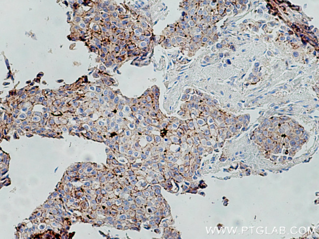 F11R Antibody in Immunohistochemistry (Paraffin) (IHC (P))