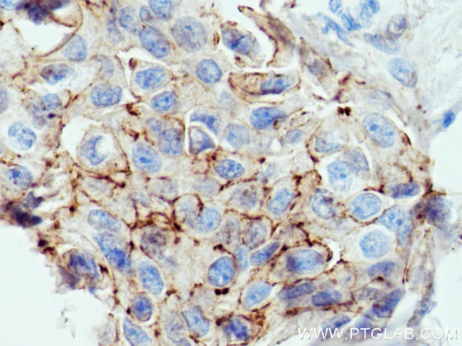 F11R Antibody in Immunohistochemistry (Paraffin) (IHC (P))