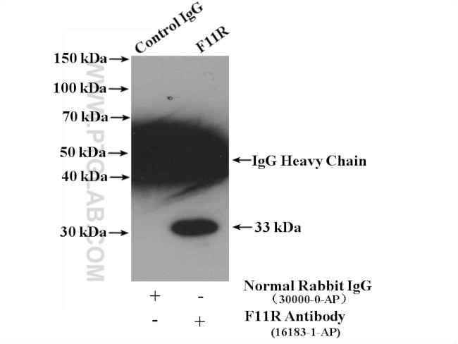 F11R Antibody in Immunoprecipitation (IP)