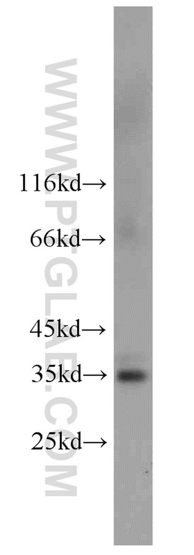 FcRn Antibody in Western Blot (WB)