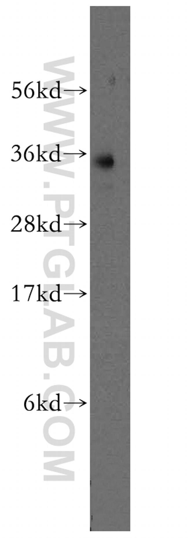 FcRn Antibody in Western Blot (WB)