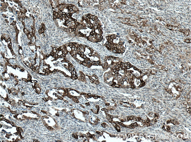 Claudin 4 Antibody in Immunohistochemistry (Paraffin) (IHC (P))