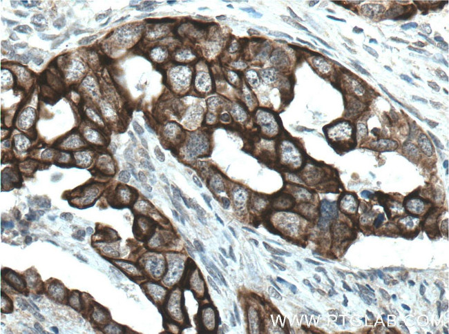 Claudin 4 Antibody in Immunohistochemistry (Paraffin) (IHC (P))