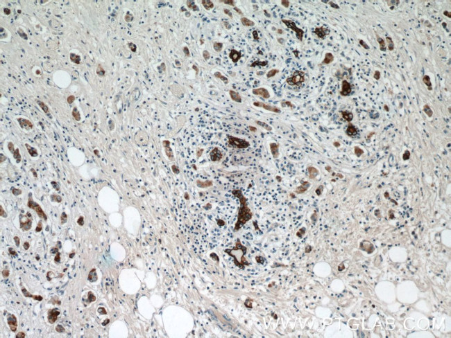 Claudin 4 Antibody in Immunohistochemistry (Paraffin) (IHC (P))