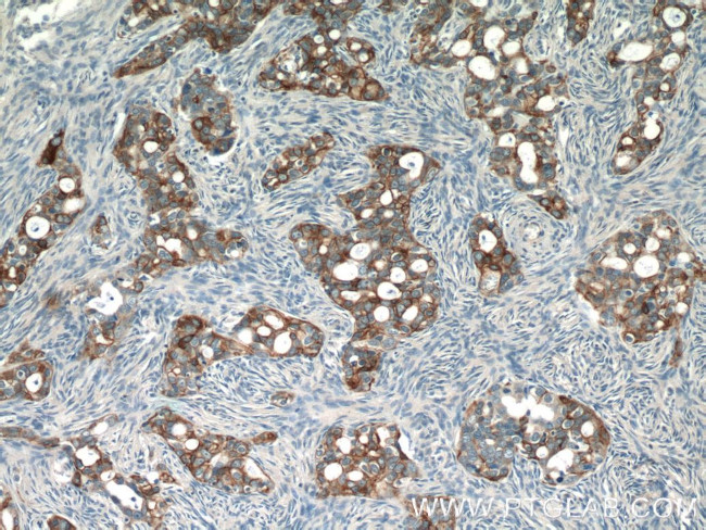 Claudin 4 Antibody in Immunohistochemistry (Paraffin) (IHC (P))