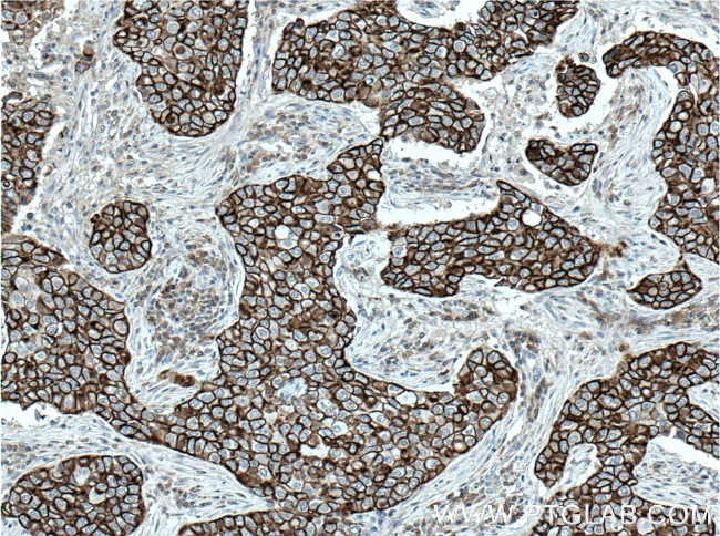 Claudin 4 Antibody in Immunohistochemistry (Paraffin) (IHC (P))