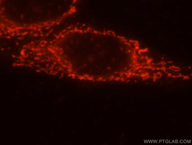 FRK Antibody in Immunocytochemistry (ICC/IF)